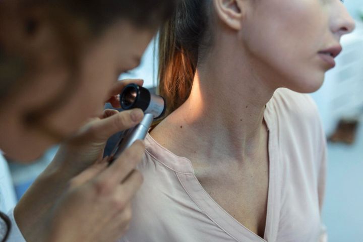 В Татарстане за июль было выявлено более 160 случаев меланомы кожи