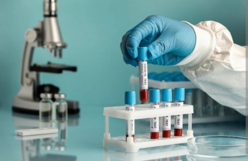 Новые данные показали, что пациентов с COVID-19 убивал не цитокиновый шторм, а бактерии