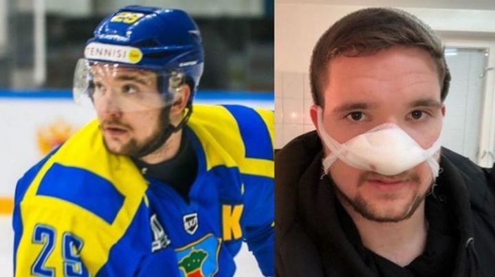 Во время матча ВХЛ хоккеисту «Челнов» срезало кончик носа